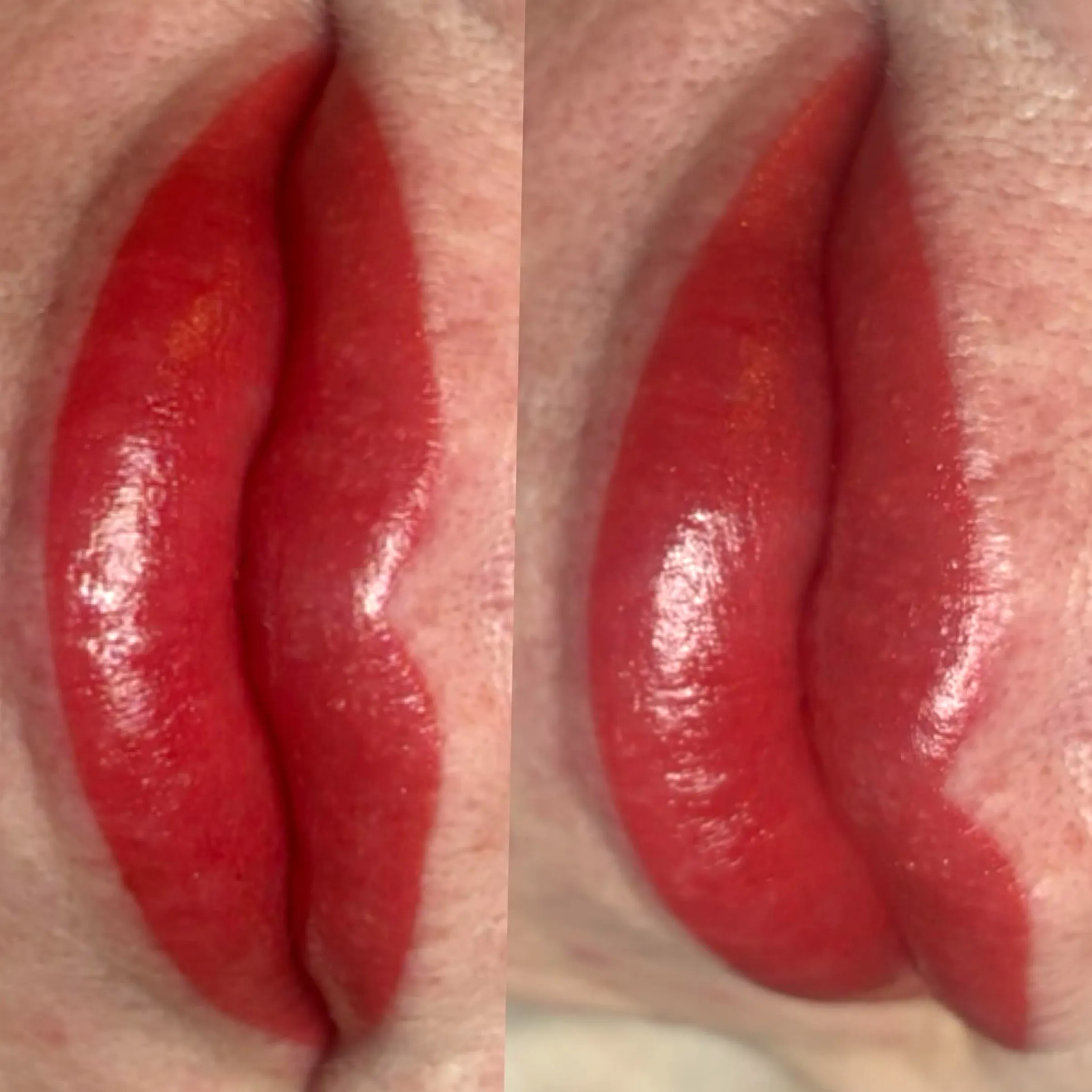Is It Possible to Correct a Fresh Lip Tattoo?