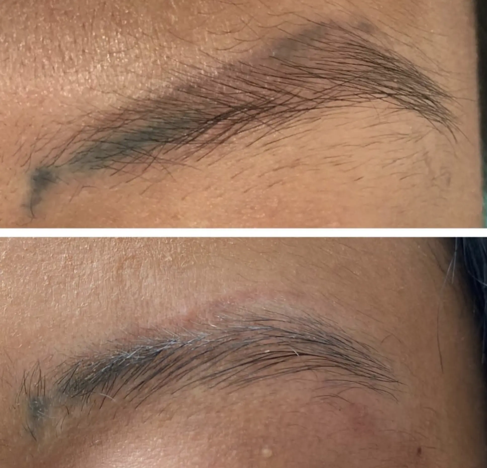 cosmetic eyebrow tattooing