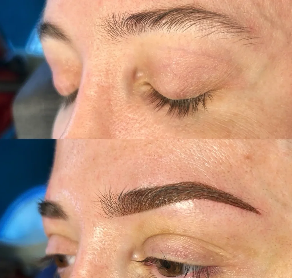 cosmetic tattooing australia