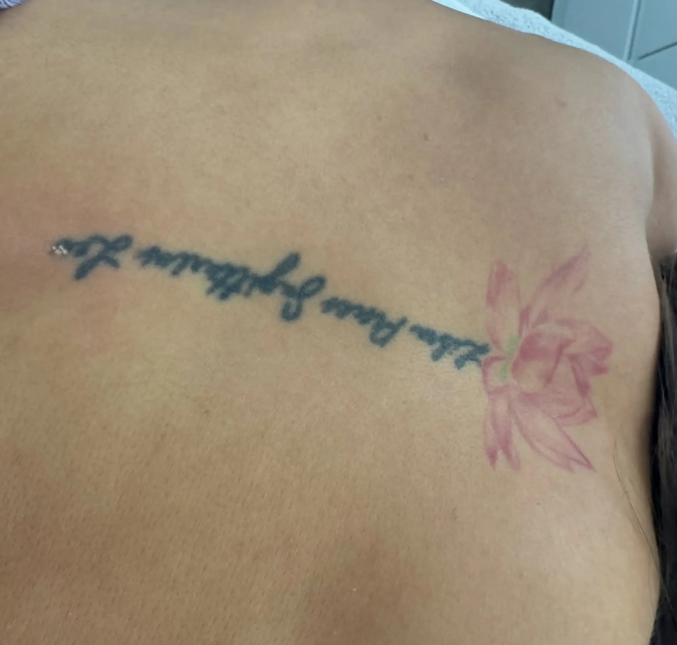 laser tattoo removal melbourne cbd scaled