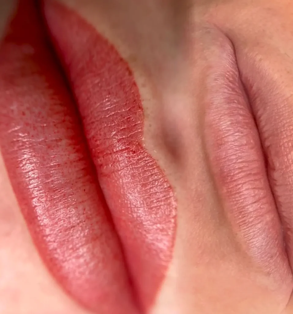 skin types that dont suit tattoo pigment