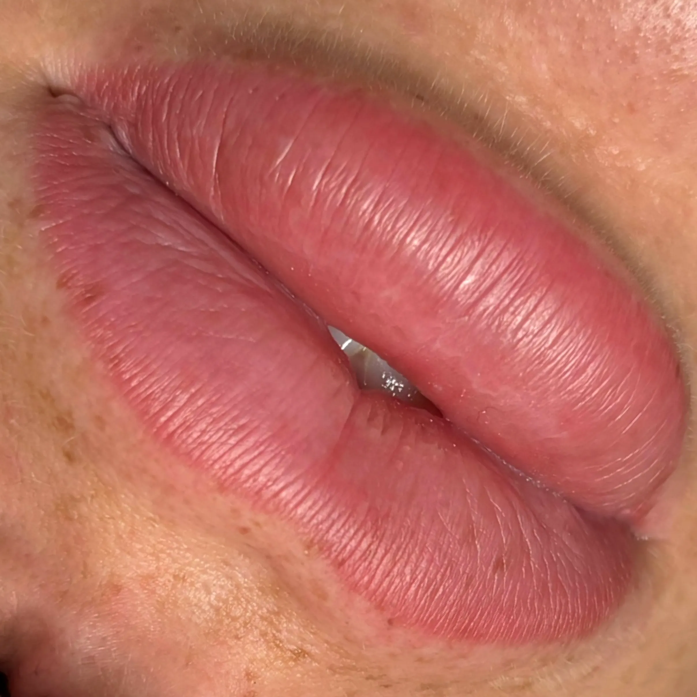 why is my lip blush bright